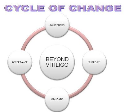 Cycle of change | Beyond Vitiligo | Vitiligo Support group in South Africa