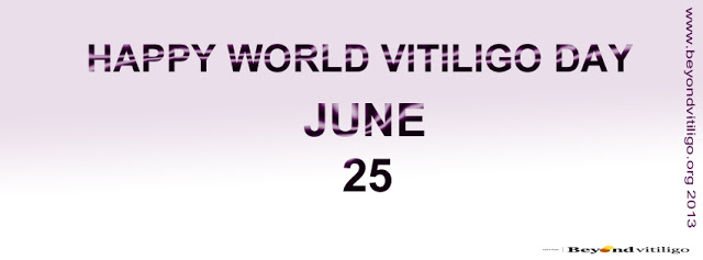 Happy world vitiligo day | 25 June | Beyond Vitiligo