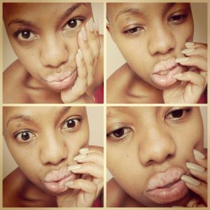 Tebby Mphela vitiligo story | Vitiligo in South Africa | Beyond Vitiligo