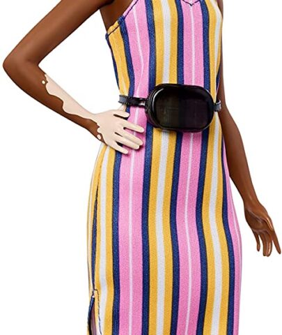 Barbie fashionista | Vitiligo | Accessories | Beyond Vitiligo